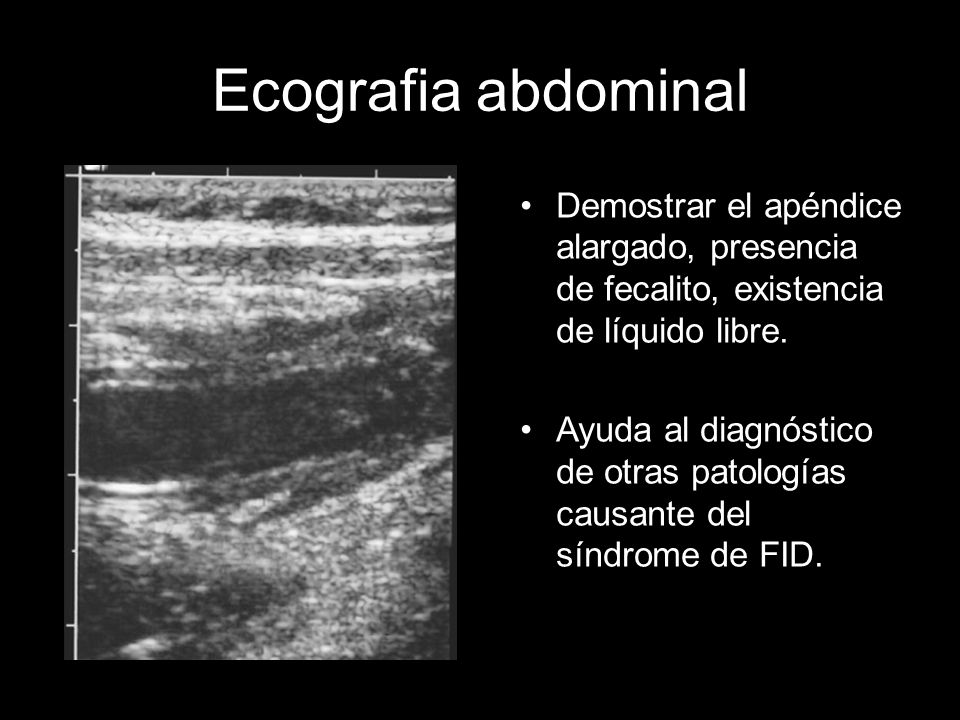 Ecografia abdominal Demostrar el apéndice alargado, presencia de fecalito, existencia de líquido libre.