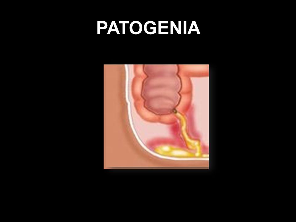 PATOGENIA