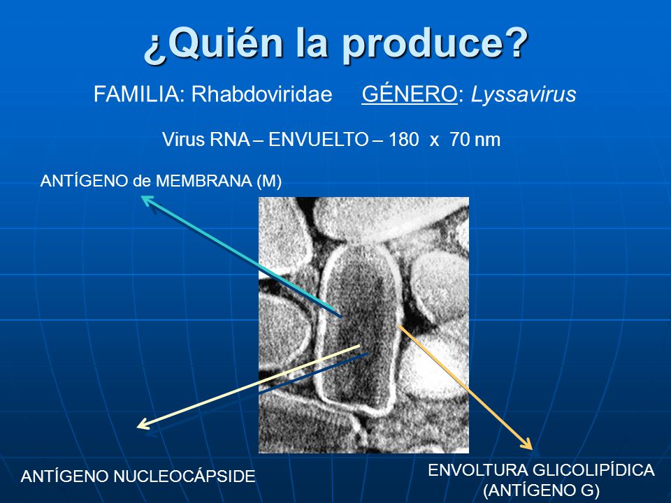 ¿Quién la produce FAMILIA: Rhabdoviridae GÉNERO: Lyssavirus