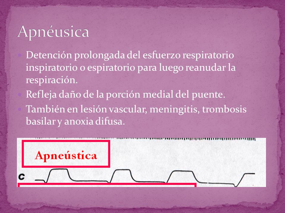 Apnéusica Detención prolongada del esfuerzo respiratorio inspiratorio o espiratorio para luego reanudar la respiración.