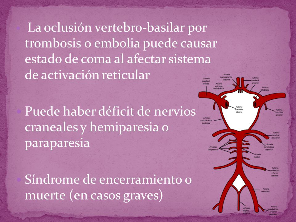 Puede haber déficit de nervios craneales y hemiparesia o paraparesia
