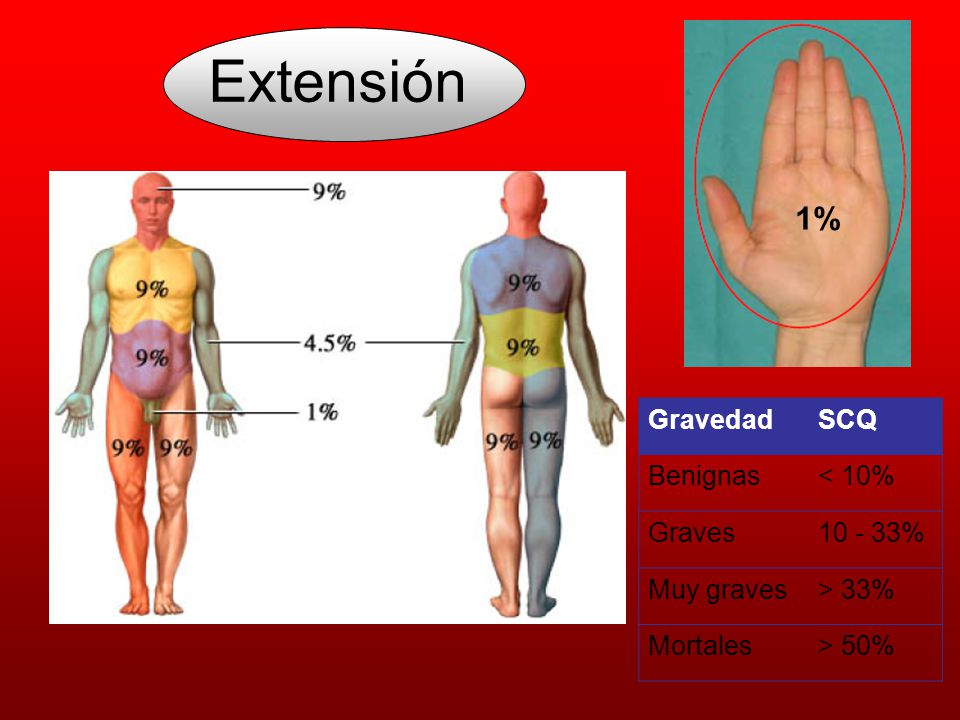 Extensión 1% Gravedad SCQ Benignas < 10% Graves % Muy graves