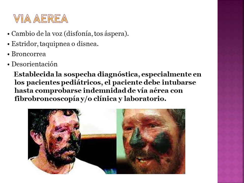 VIA AEREA • Cambio de la voz (disfonía, tos áspera).