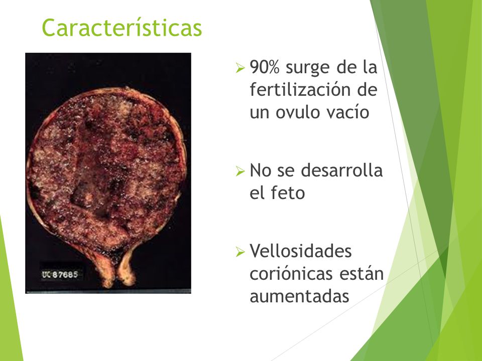 Características 90% surge de la fertilización de un ovulo vacío