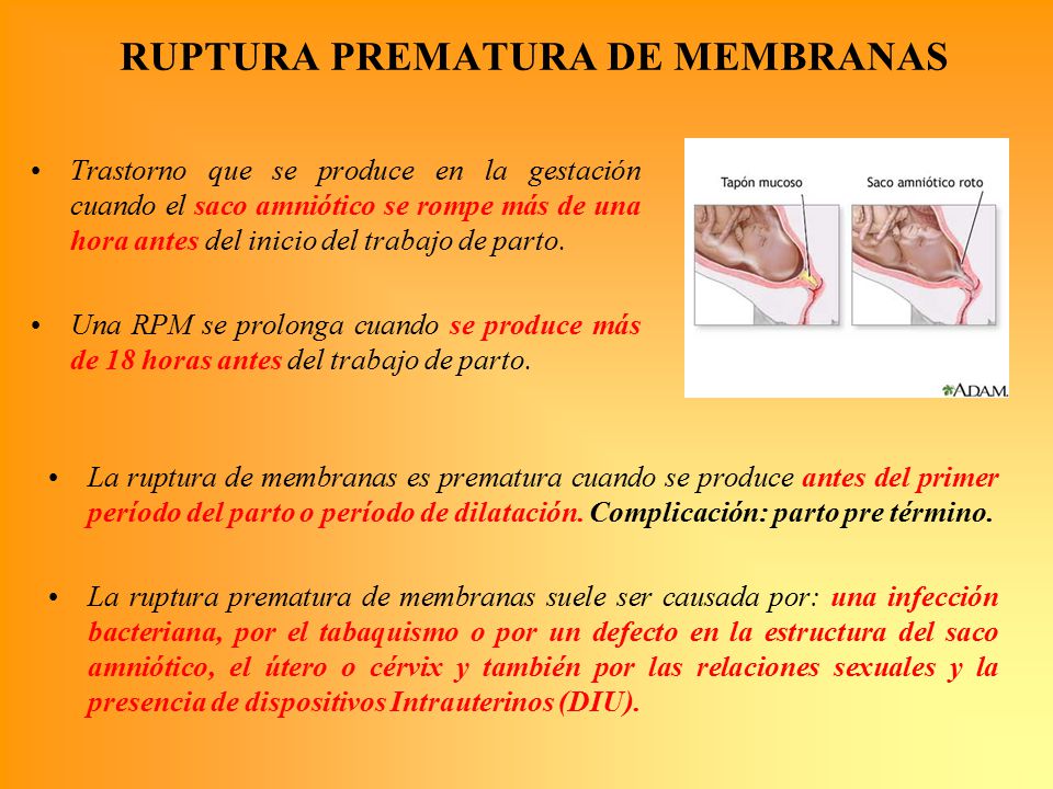 RUPTURA PREMATURA DE MEMBRANAS