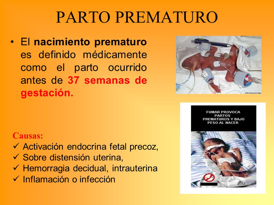 PARTO PREMATURO El nacimiento prematuro es definido médicamente como el parto ocurrido antes de 37 semanas de gestación.