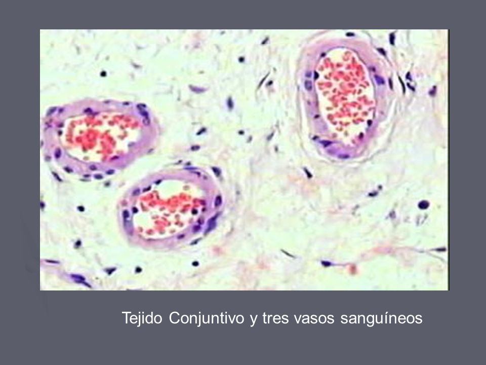 Tejido Conjuntivo y tres vasos sanguíneos