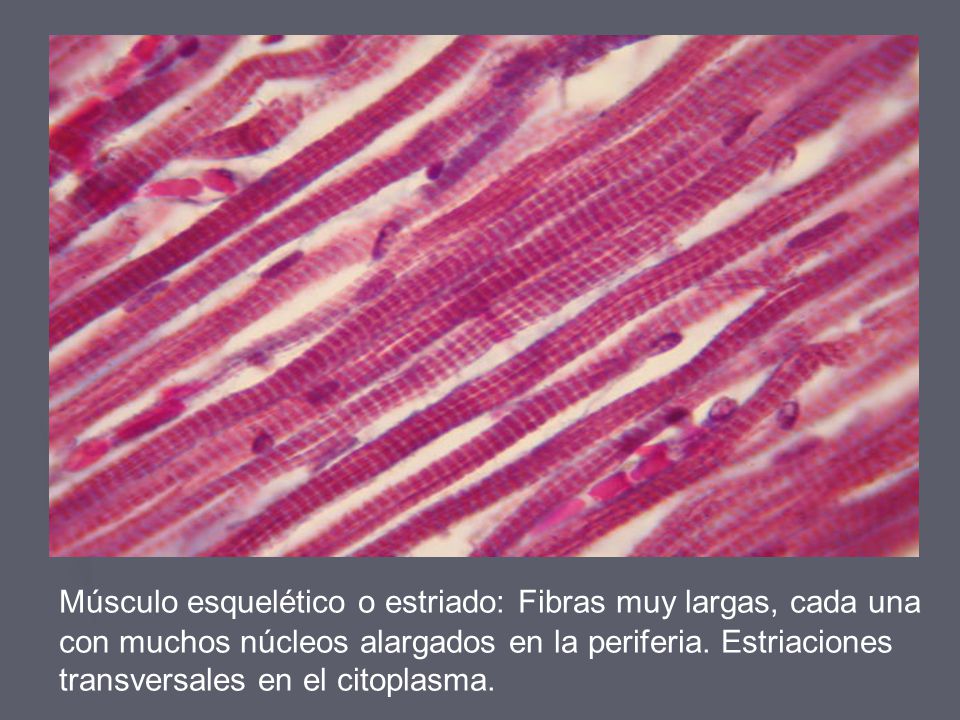 Músculo esquelético o estriado: Fibras muy largas, cada una con muchos núcleos alargados en la periferia.
