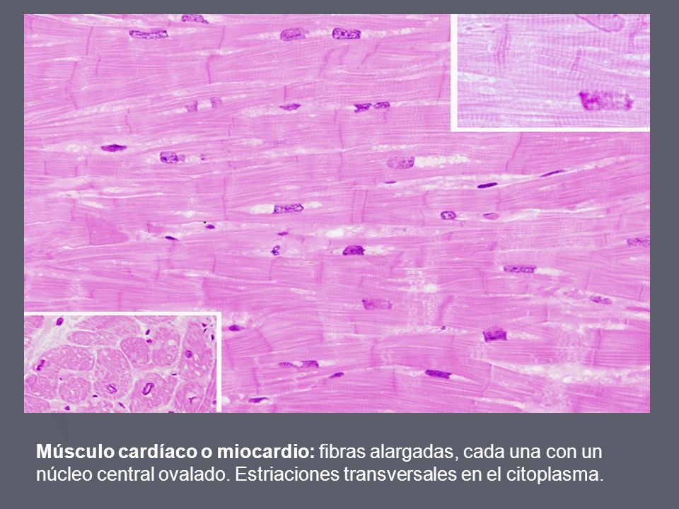 Músculo cardíaco o miocardio: fibras alargadas, cada una con un núcleo central ovalado.