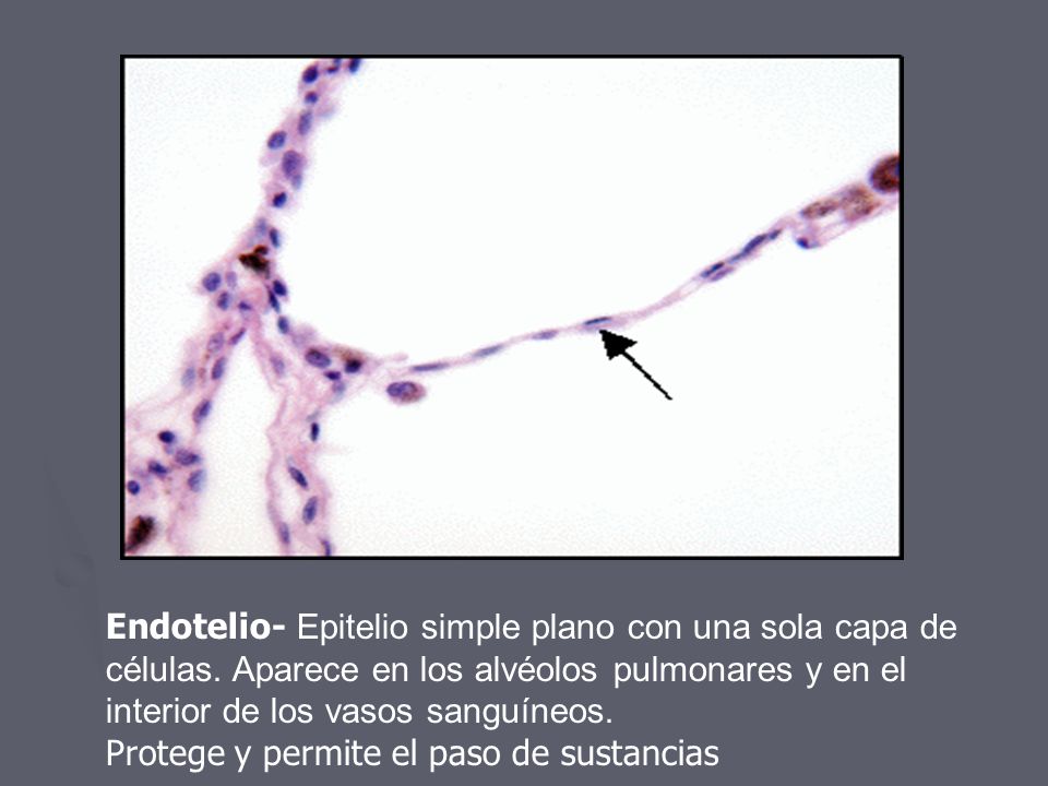 Endotelio- Epitelio simple plano con una sola capa de células