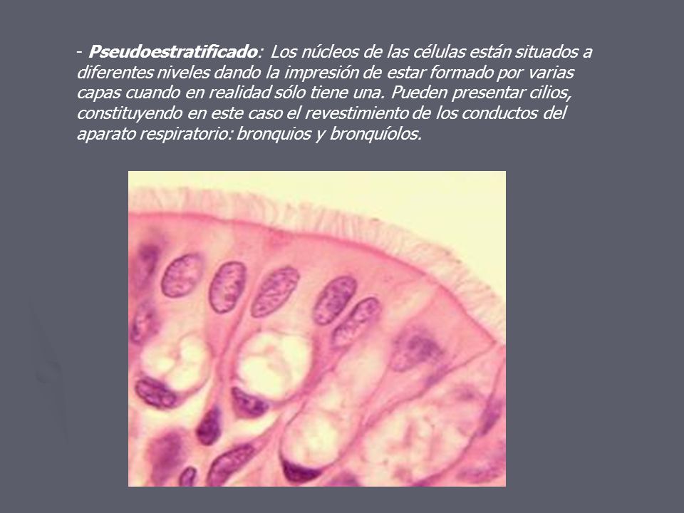 - Pseudoestratificado: Los núcleos de las células están situados a diferentes niveles dando la impresión de estar formado por varias capas cuando en realidad sólo tiene una.