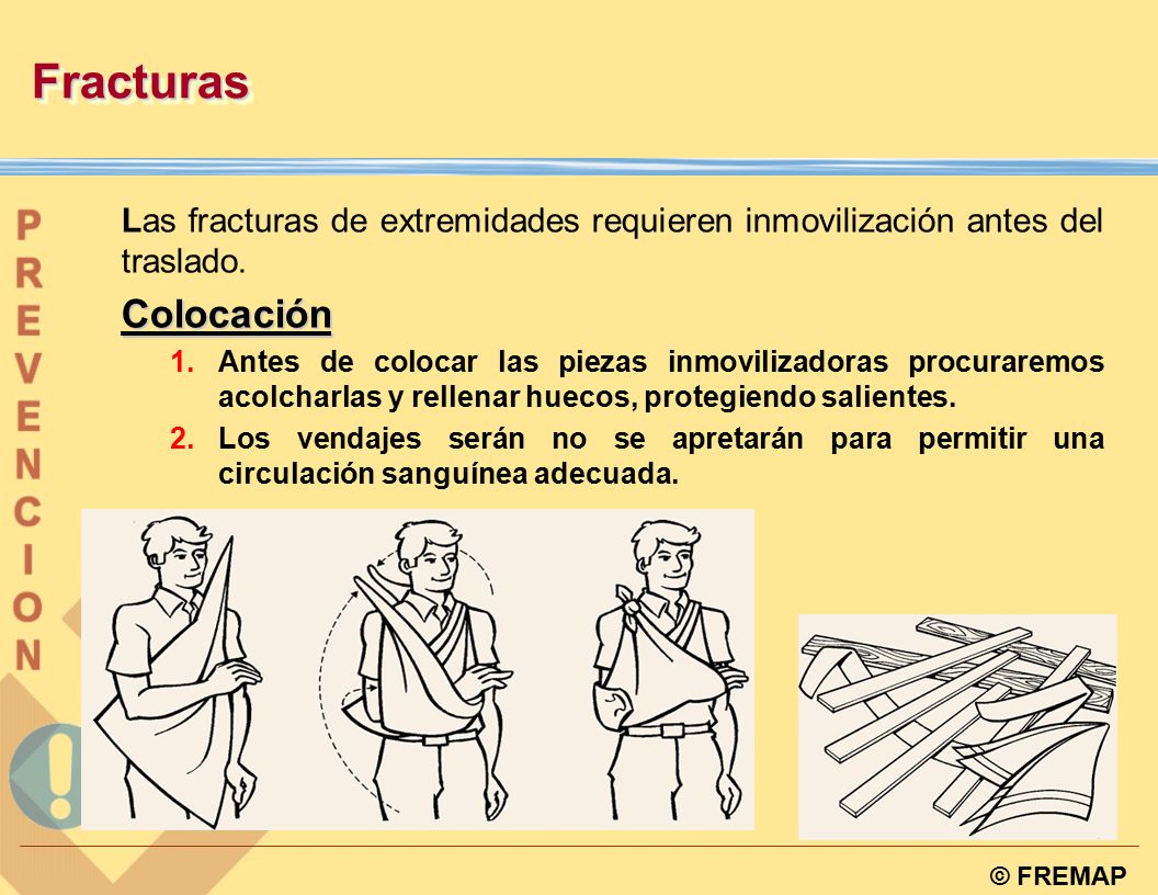 Fracturas Las fracturas de extremidades requieren inmovilización antes del traslado. Colocación.