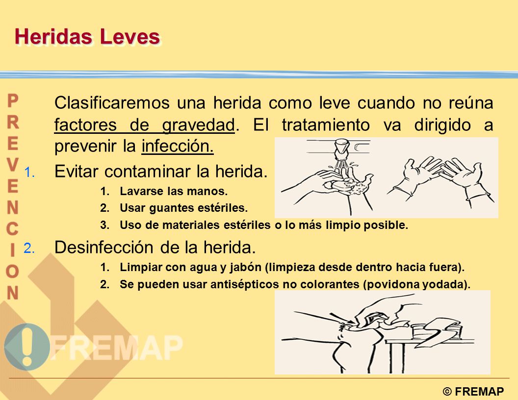 Heridas Leves Clasificaremos una herida como leve cuando no reúna factores de gravedad. El tratamiento va dirigido a prevenir la infección.