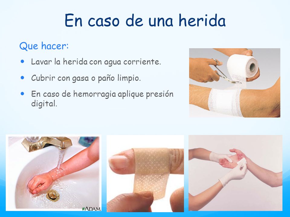En caso de una herida Que hacer: Lavar la herida con agua corriente.