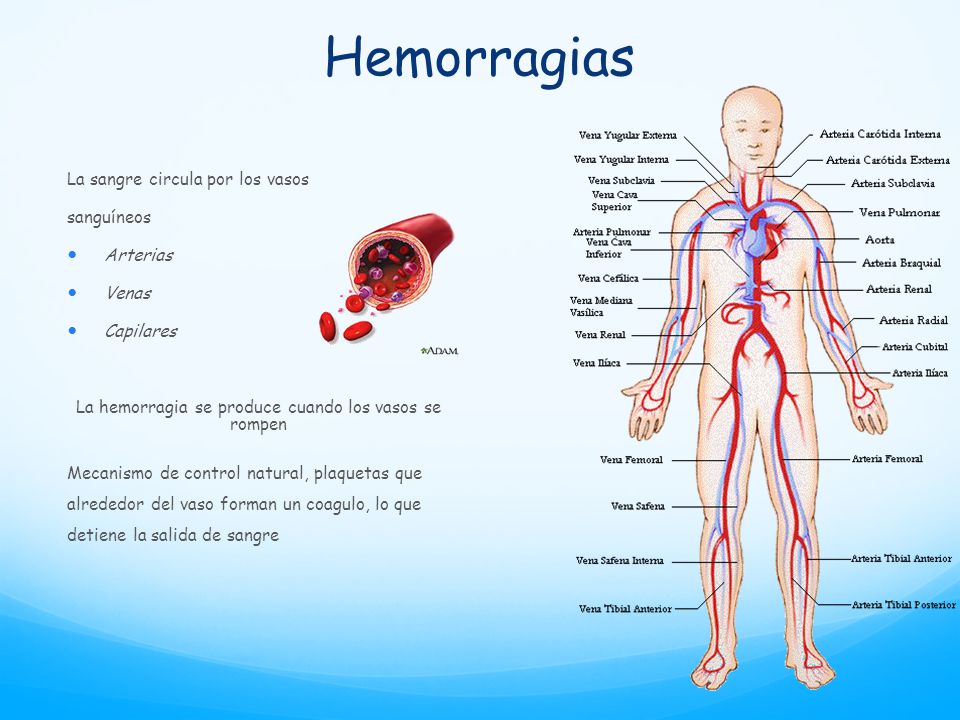 La hemorragia se produce cuando los vasos se rompen