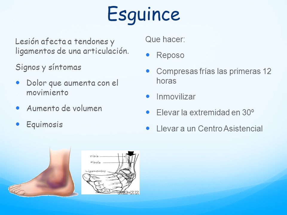 Esguince Que hacer: Reposo. Compresas frías las primeras 12 horas. Inmovilizar. Elevar la extremidad en 30º.