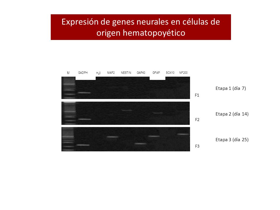Expresión de genes neurales en células de origen hematopoyético