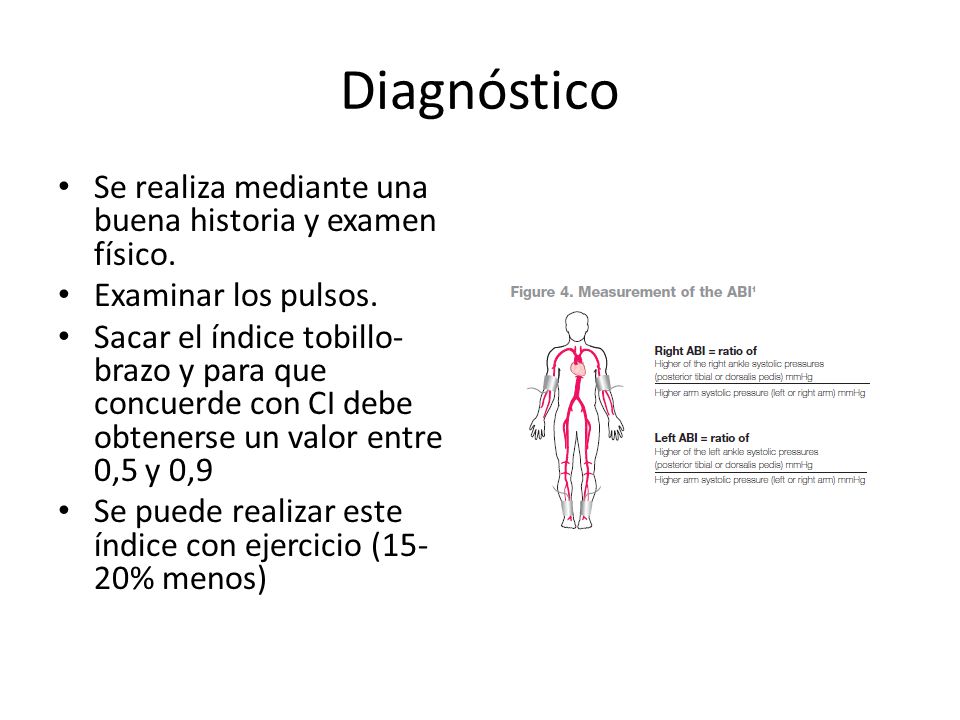 Diagnóstico Se realiza mediante una buena historia y examen físico.