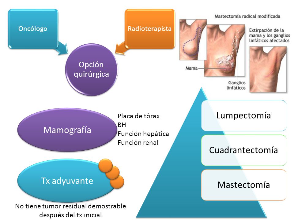 No tiene tumor residual demostrable después del tx inicial