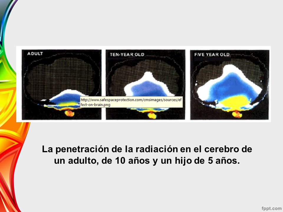 La penetración de la radiación en el cerebro de un adulto, de 10 años y un hijo de 5 años.