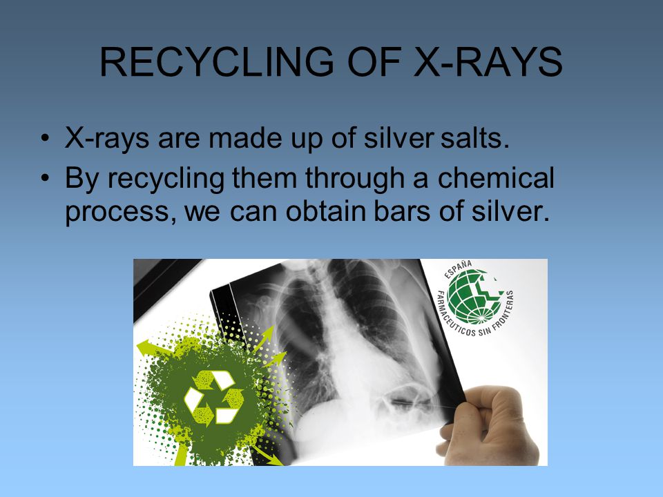 RECYCLING OF X-RAYS X-rays are made up of silver salts.