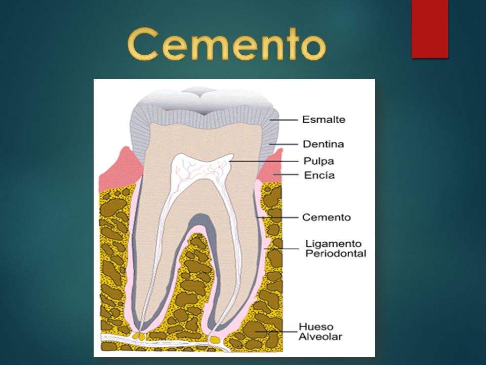 Cemento