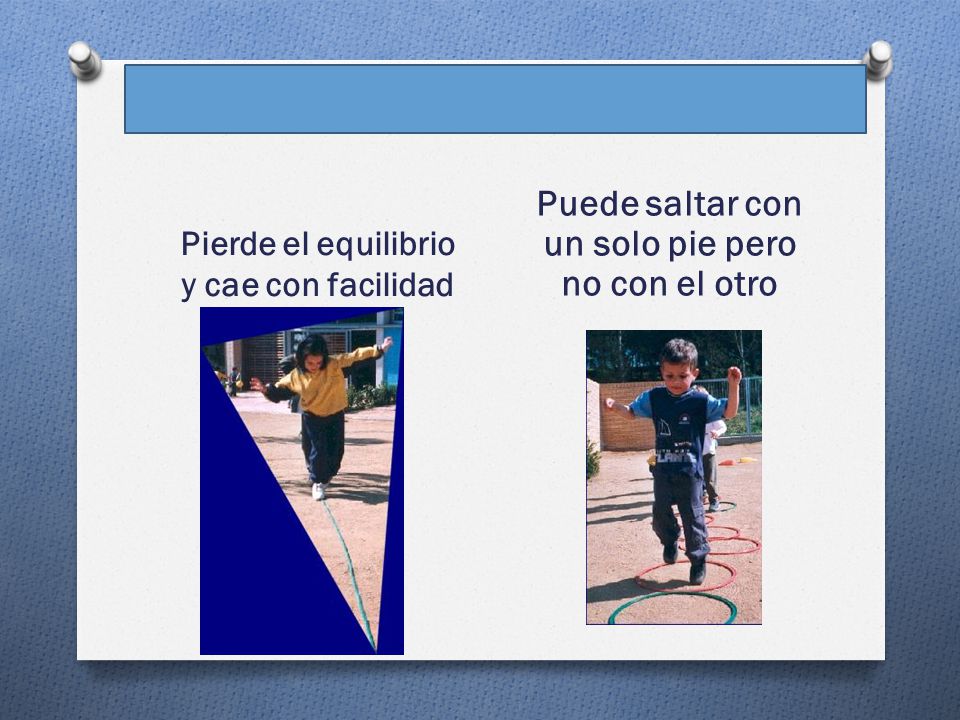 Puede saltar con un solo pie pero no con el otro