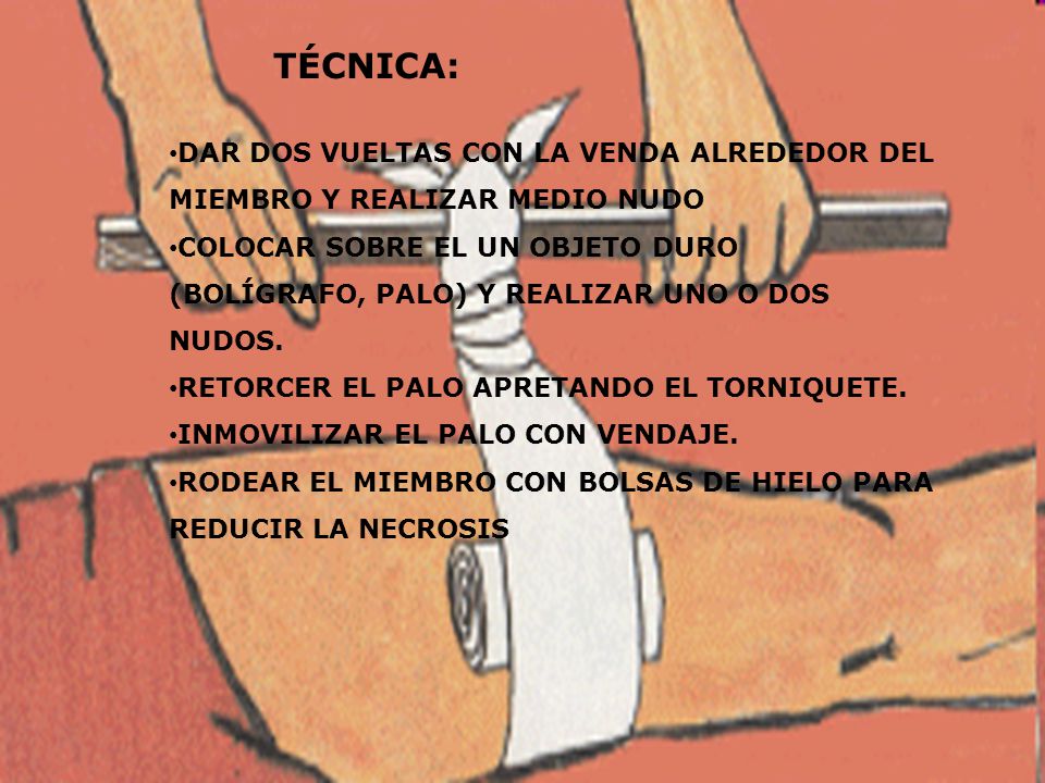 TÉCNICA: DAR DOS VUELTAS CON LA VENDA ALREDEDOR DEL MIEMBRO Y REALIZAR MEDIO NUDO.