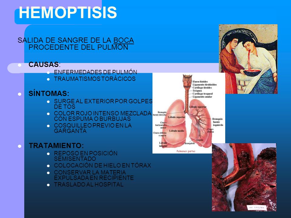 HEMOPTISIS SALIDA DE SANGRE DE LA BOCA PROCEDENTE DEL PULMÓN CAUSAS: