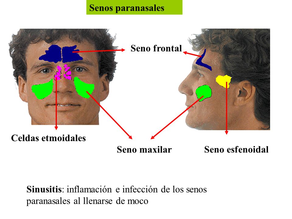 Senos paranasales Seno frontal. Celdas etmoidales. Seno maxilar. Seno esfenoidal.