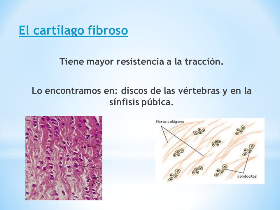 El cartílago fibroso Tiene mayor resistencia a la tracción.