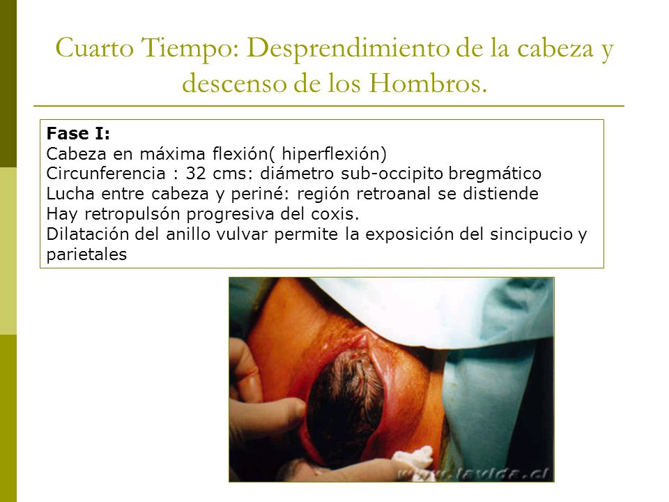 Cuarto Tiempo: Desprendimiento de la cabeza y descenso de los Hombros.