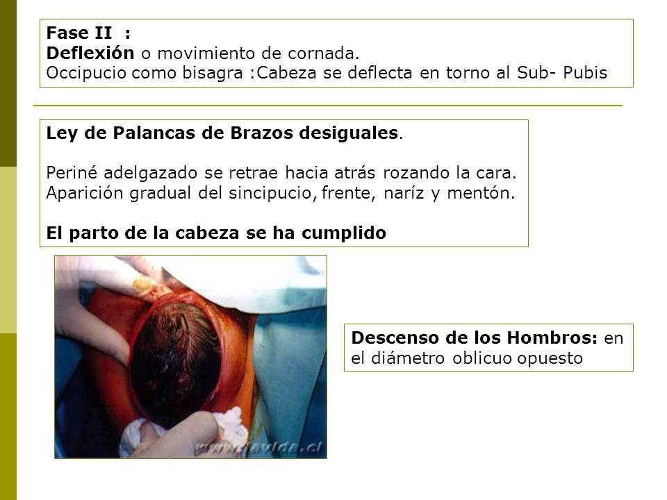 Fase II : Deflexión o movimiento de cornada. Occipucio como bisagra :Cabeza se deflecta en torno al Sub- Pubis.