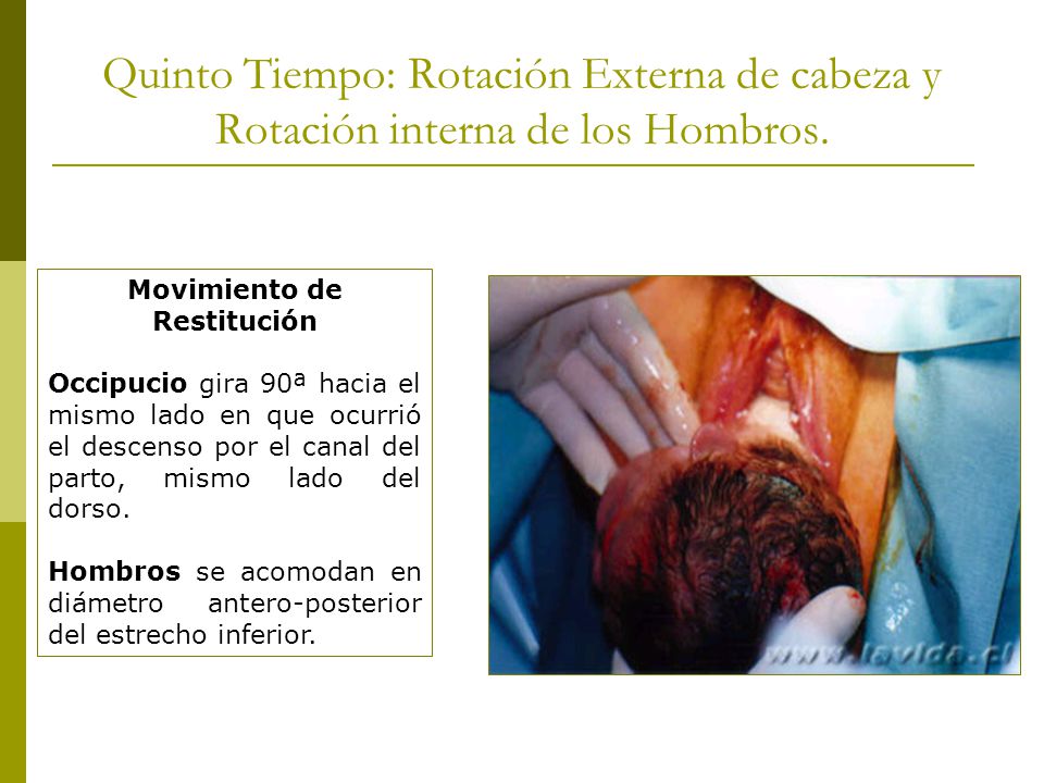 Movimiento de Restitución