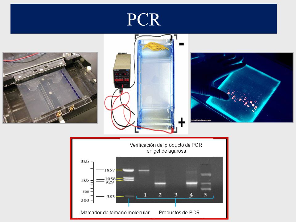 PCR Verificación del producto de PCR en gel de agarosa