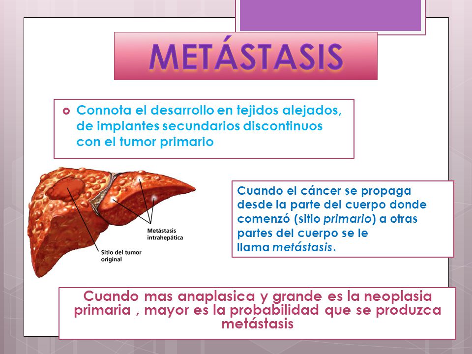 METÁSTASIS Connota el desarrollo en tejidos alejados, de implantes secundarios discontinuos con el tumor primario.