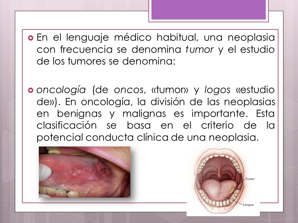 En el lenguaje médico habitual, una neoplasia con frecuencia se denomina tumor y el estudio de los tumores se denomina: