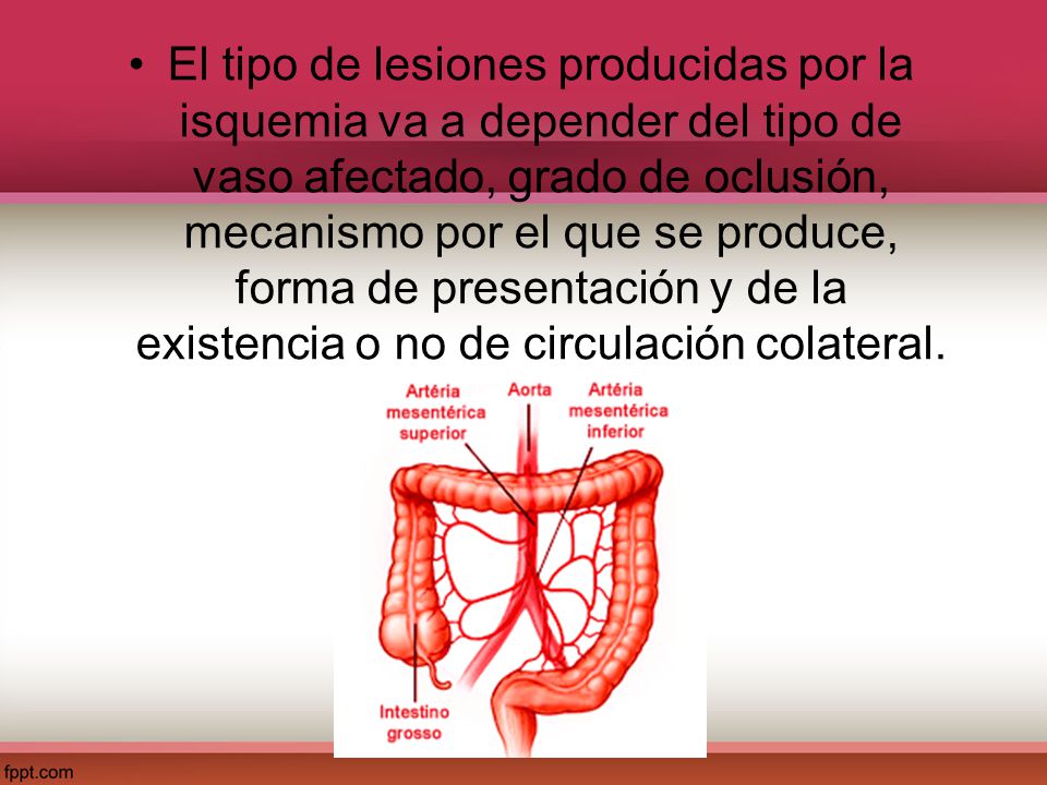 El tipo de lesiones producidas por la isquemia va a depender del tipo de vaso afectado, grado de oclusión, mecanismo por el que se produce, forma de presentación y de la existencia o no de circulación colateral.