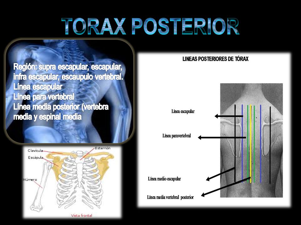 TORAX POSTERIOR Región: supra escapular, escapular, infra escapular, escaupulo vertebral. Línea escapular.