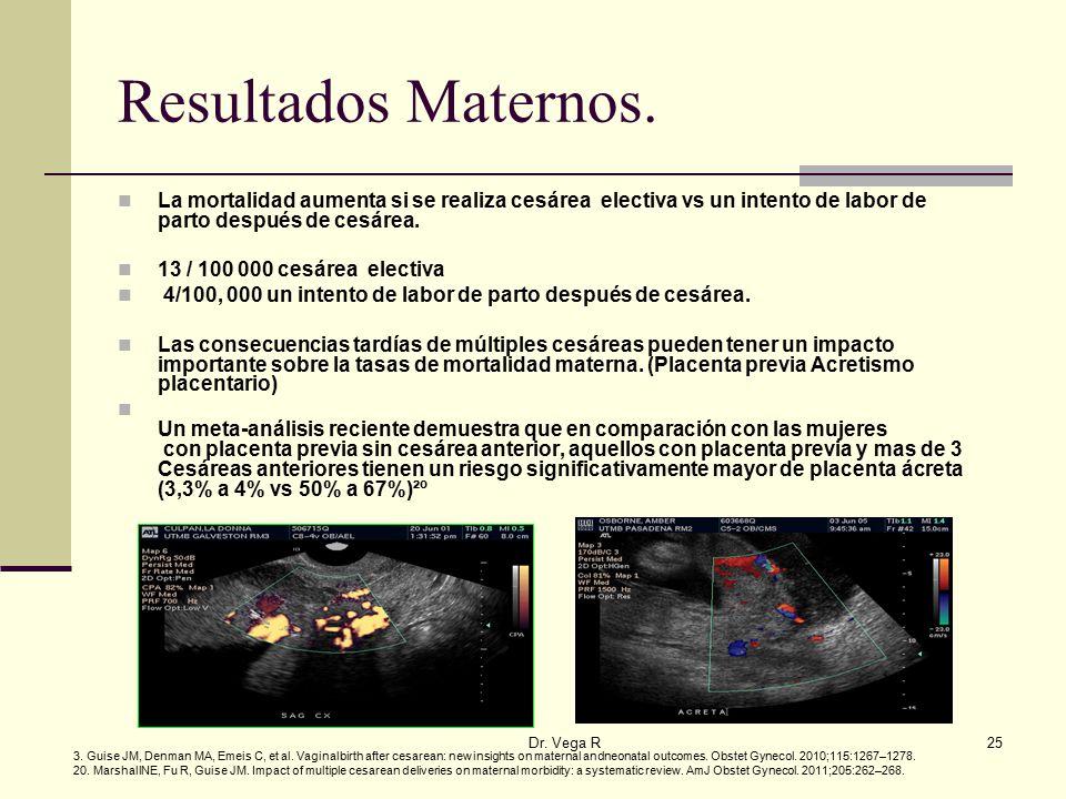 Resultados Maternos. La mortalidad aumenta si se realiza cesárea electiva vs un intento de labor de parto después de cesárea.