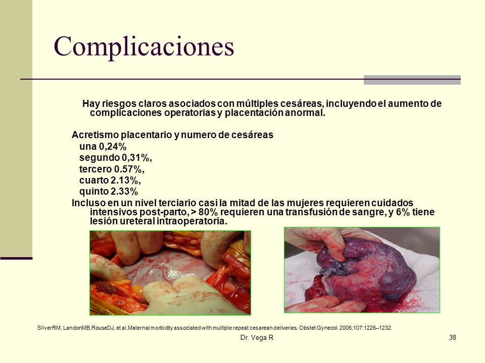 Complicaciones Hay riesgos claros asociados con múltiples cesáreas, incluyendo el aumento de complicaciones operatorias y placentación anormal.
