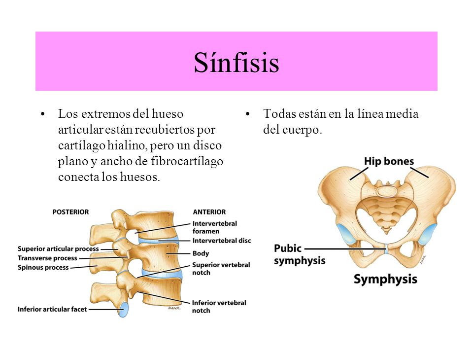 Sínfisis Los extremos del hueso articular están recubiertos por cartílago hialino, pero un disco plano y ancho de fibrocartílago conecta los huesos.