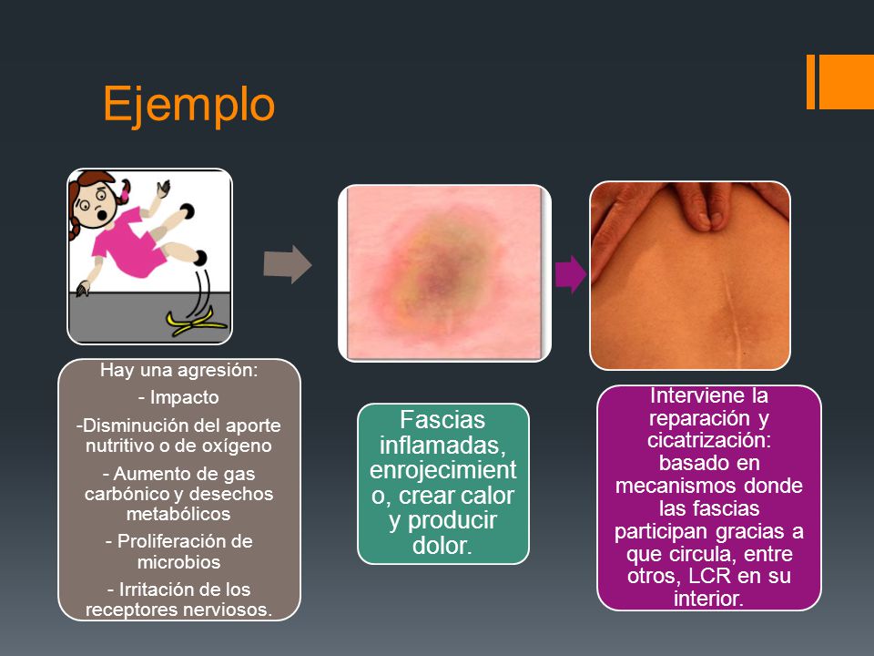 Ejemplo Hay una agresión: - Impacto. -Disminución del aporte nutritivo o de oxígeno. - Aumento de gas carbónico y desechos metabólicos.
