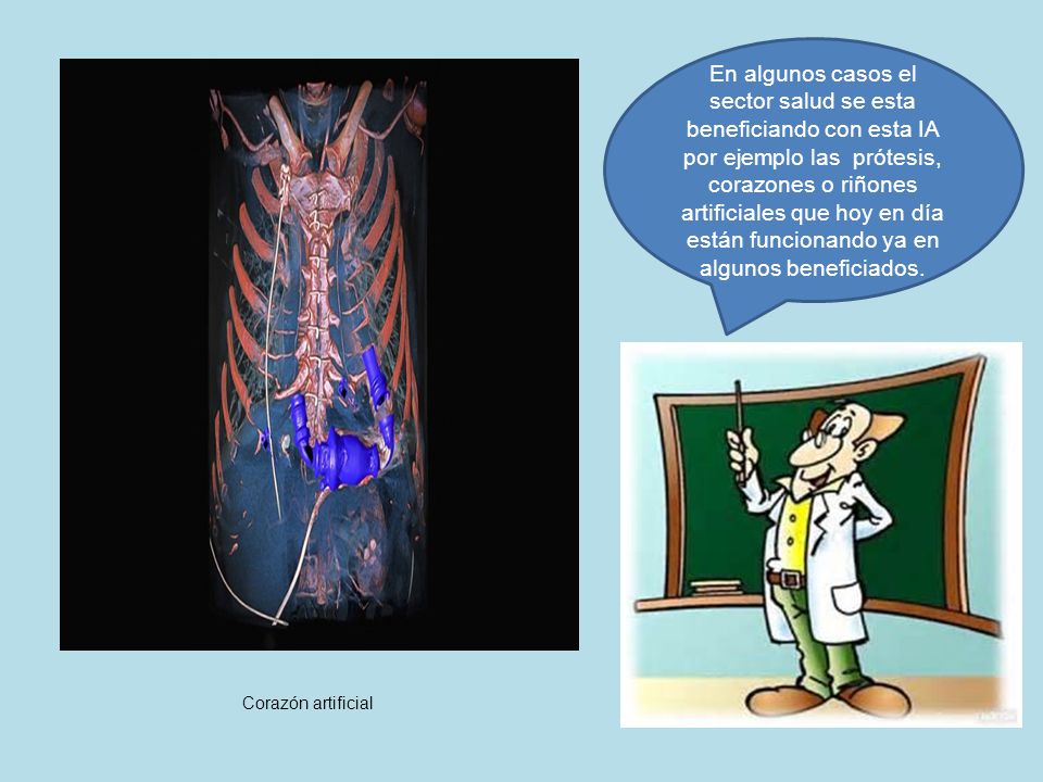 En algunos casos el sector salud se esta beneficiando con esta IA por ejemplo las prótesis, corazones o riñones artificiales que hoy en día están funcionando ya en algunos beneficiados.