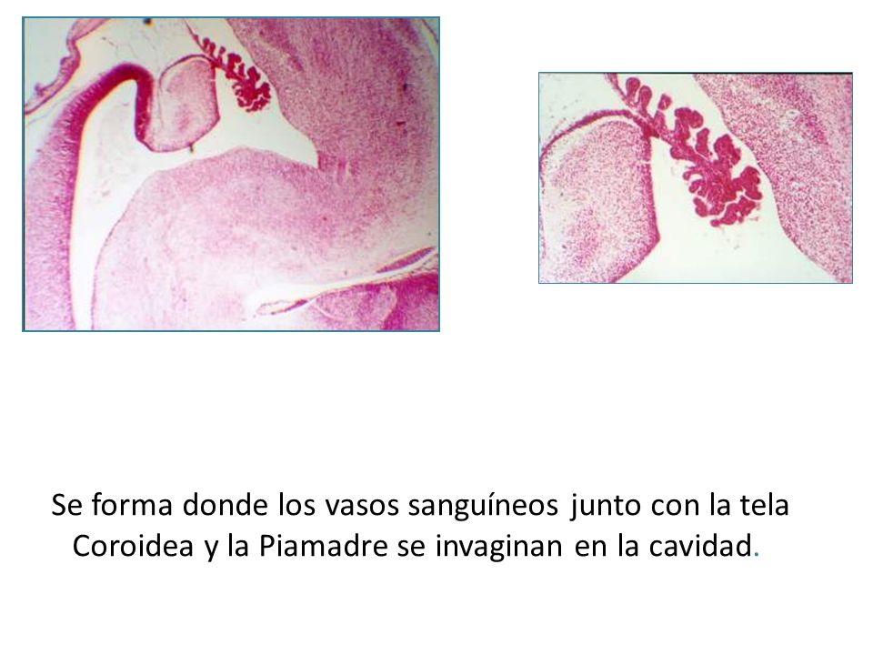 Se forma donde los vasos sanguíneos junto con la tela