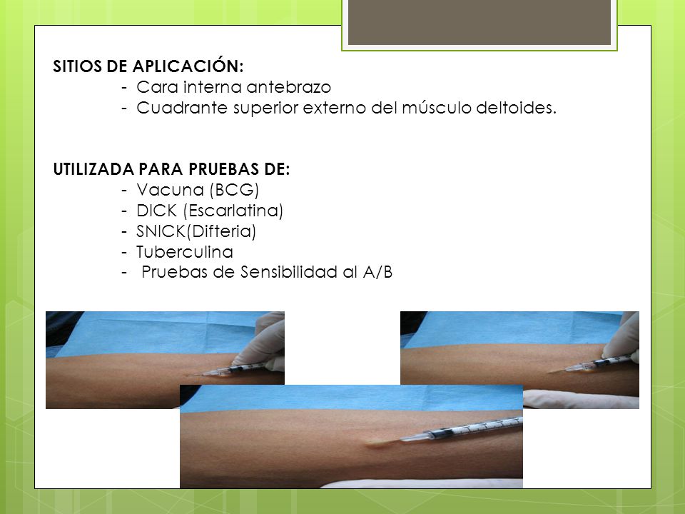 SITIOS DE APLICACIÓN: - Cara interna antebrazo. - Cuadrante superior externo del músculo deltoides.