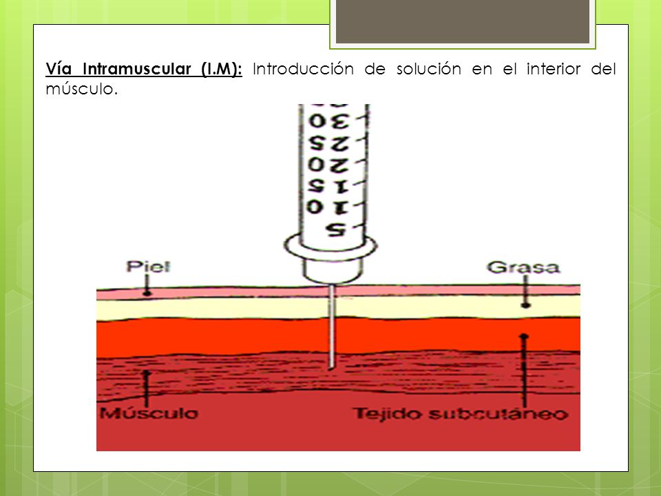 Vía Intramuscular (I.M): Introducción de solución en el interior del músculo.