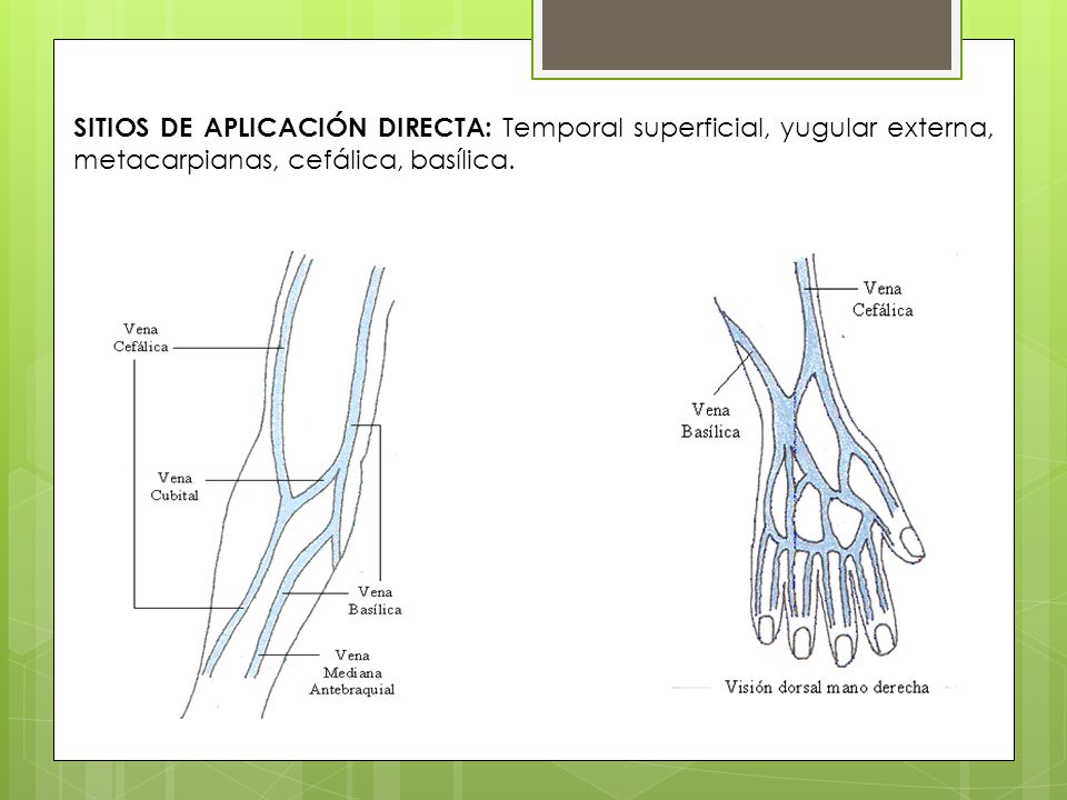 SITIOS DE APLICACIÓN DIRECTA: Temporal superficial, yugular externa, metacarpianas, cefálica, basílica.