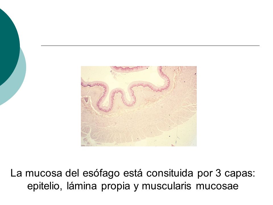 La mucosa del esófago está consituida por 3 capas: epitelio, lámina propia y muscularis mucosae