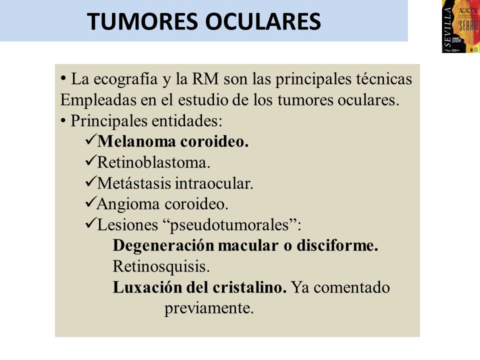 TUMORES OCULARES La ecografía y la RM son las principales técnicas